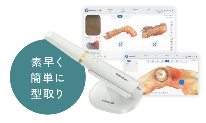 素早く簡単に型取り