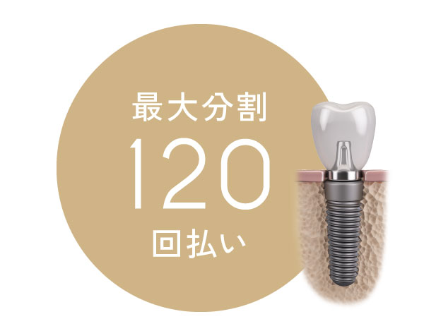 最大分割120回払い