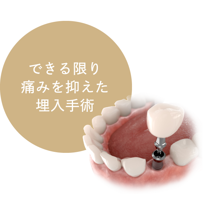 できる限り痛みを抑えた埋入手術
