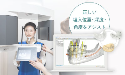 正しい埋入位置・深度・角度をアシスト